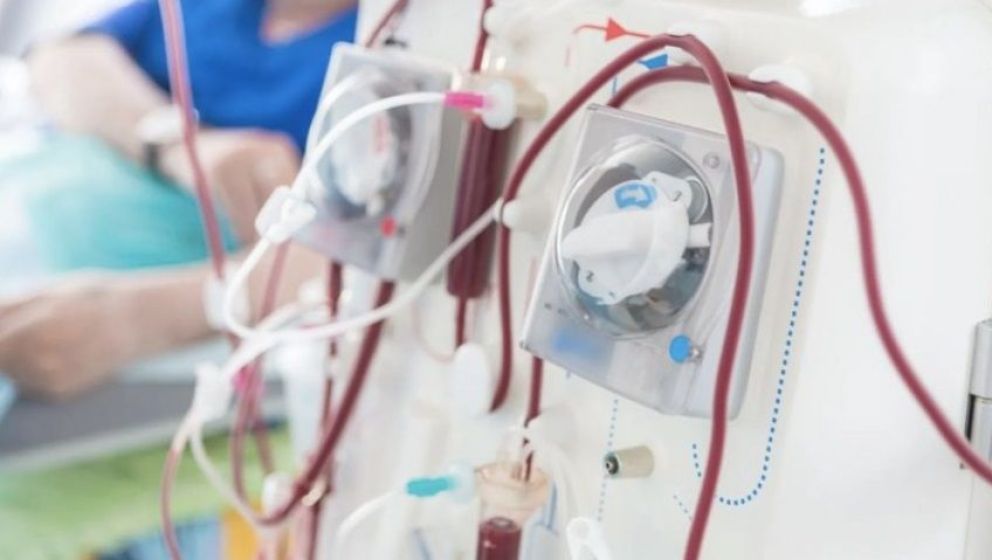 Advierten por la falta de insumos médicos para diálisis y hay unos 30.000 pacientes en peligro